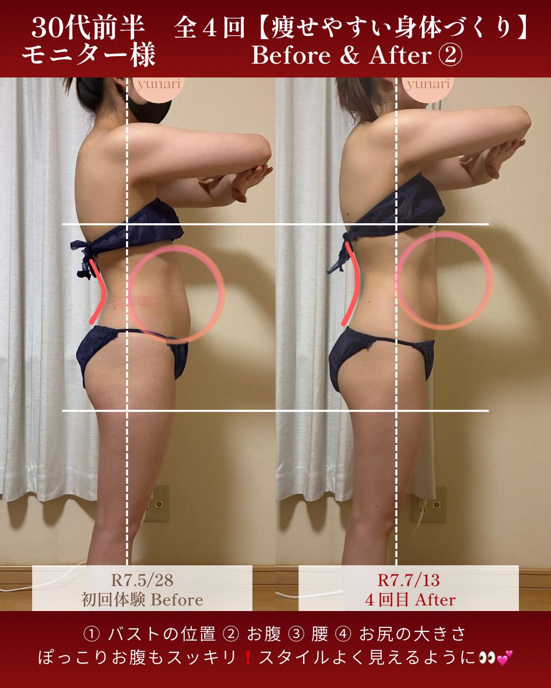 旭川市コアヒート専門温活エステサロンyunariの結果写真